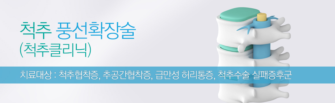 척추풍선확장술(척추클리닉) 치료대상 : 척추협착증, 추공간협착증, 급만성 허리통증, 척추수술 실패증후군